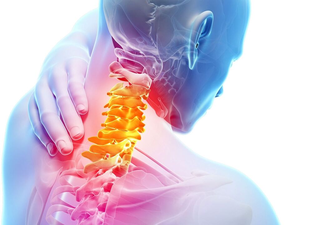 síntomas de osteocondrosis cervical